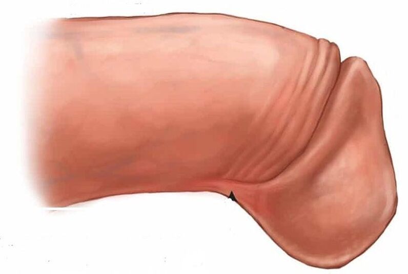 wéi de Glanz Penis ze vergréisseren